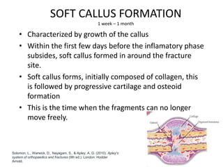 SOFT CALLUS FORMATION
1 week – 1 month
• Characterized by growth of the callus
• Within the first few days before the inflamatory phase
subsides, soft callus formed in around the fracture
site.
• Soft callus forms, initially composed of collagen, this
is followed by progressive cartilage and osteoid
formation
• This is the time when the fragments can no longer
move freely.
Solomon, L., Warwick, D., Nayagam, S., & Apley, A. G. (2010). Apley's
system of orthopaedics and fractures (9th ed.). London: Hodder
Arnold.
 