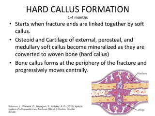 HARD CALLUS FORMATION
1-4 months
• Starts when fracture ends are linked together by soft
callus.
• Osteoid and Cartilage of external, perosteal, and
medullary soft callus become mineralized as they are
converted to woven bone (hard callus)
• Bone callus forms at the periphery of the fracture and
progressively moves centrally.
Solomon, L., Warwick, D., Nayagam, S., & Apley, A. G. (2010). Apley's
system of orthopaedics and fractures (9th ed.). London: Hodder
Arnold.
 