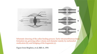Initial Callus Formation fracture healing presentation for postgraduates | PPTX