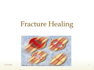 Fracture Healing
2/17/2015 1
 