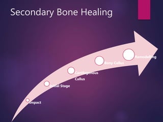 Secondary Bone Healing
Impact
Initial Stage
Cartilagenous
Callus
Bony Callus
Remodelling
 