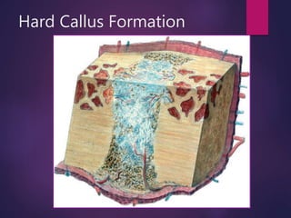 Hard Callus Formation
 