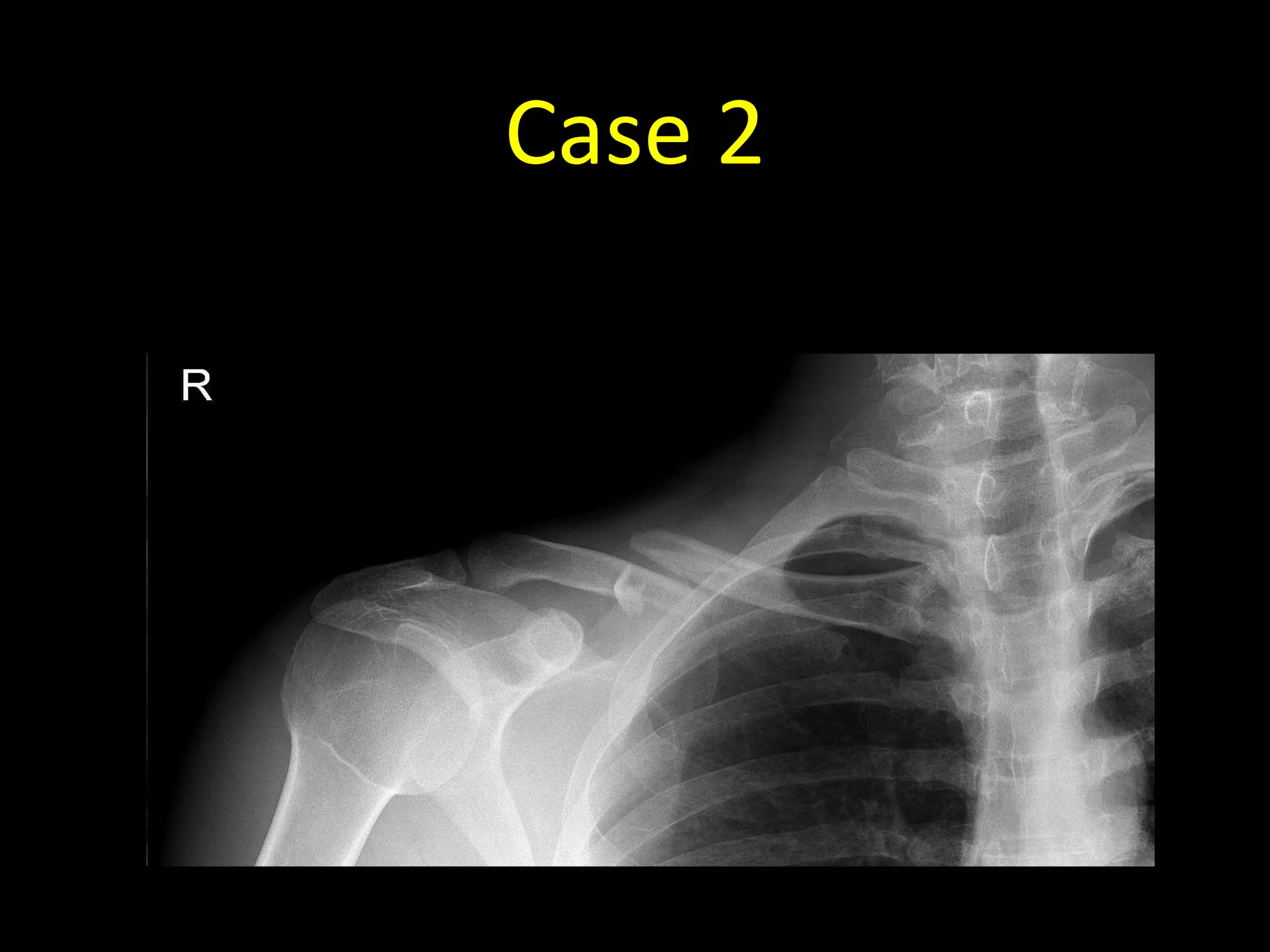Case 2
 