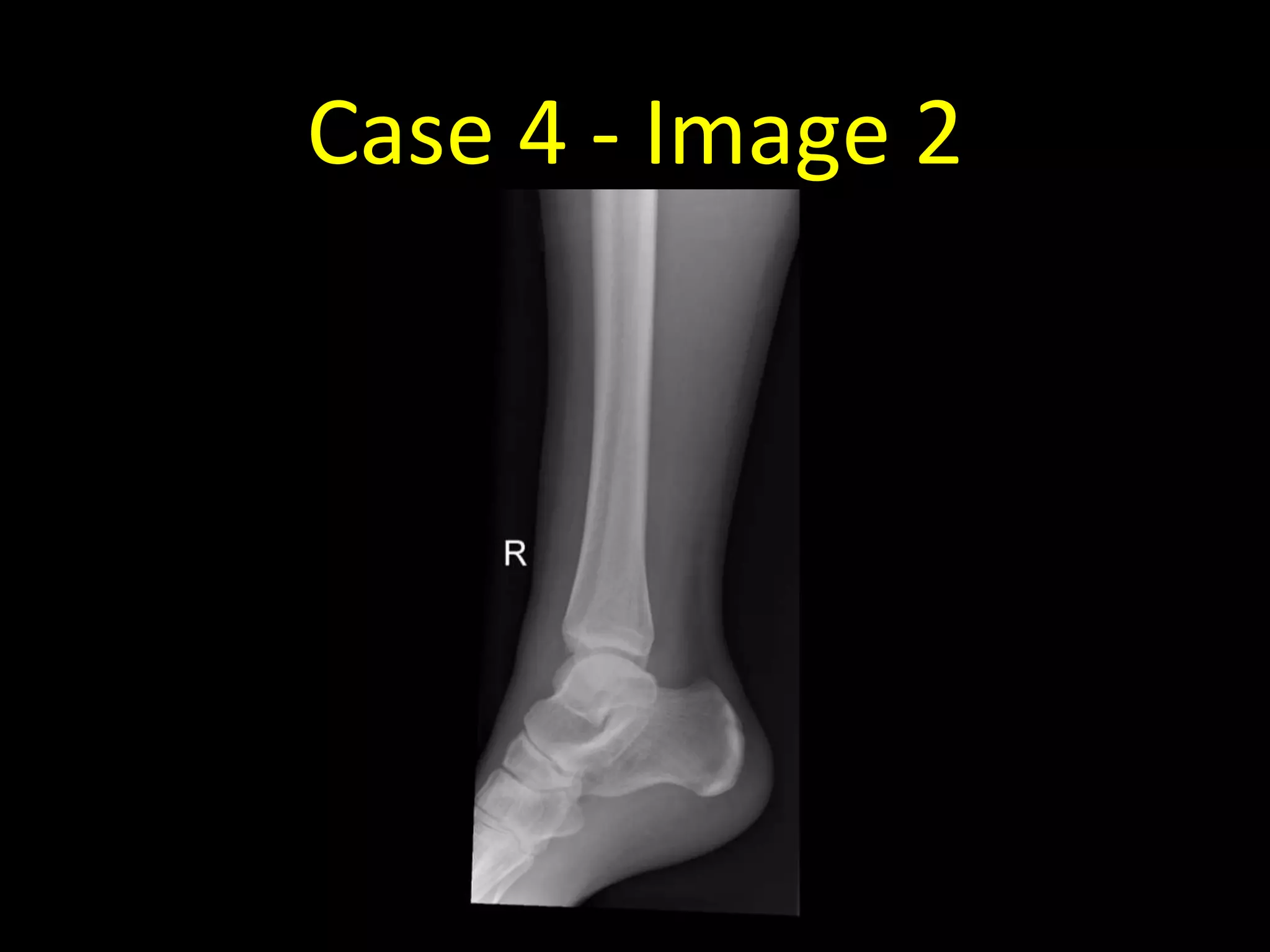 Case 4 - Image 2
 