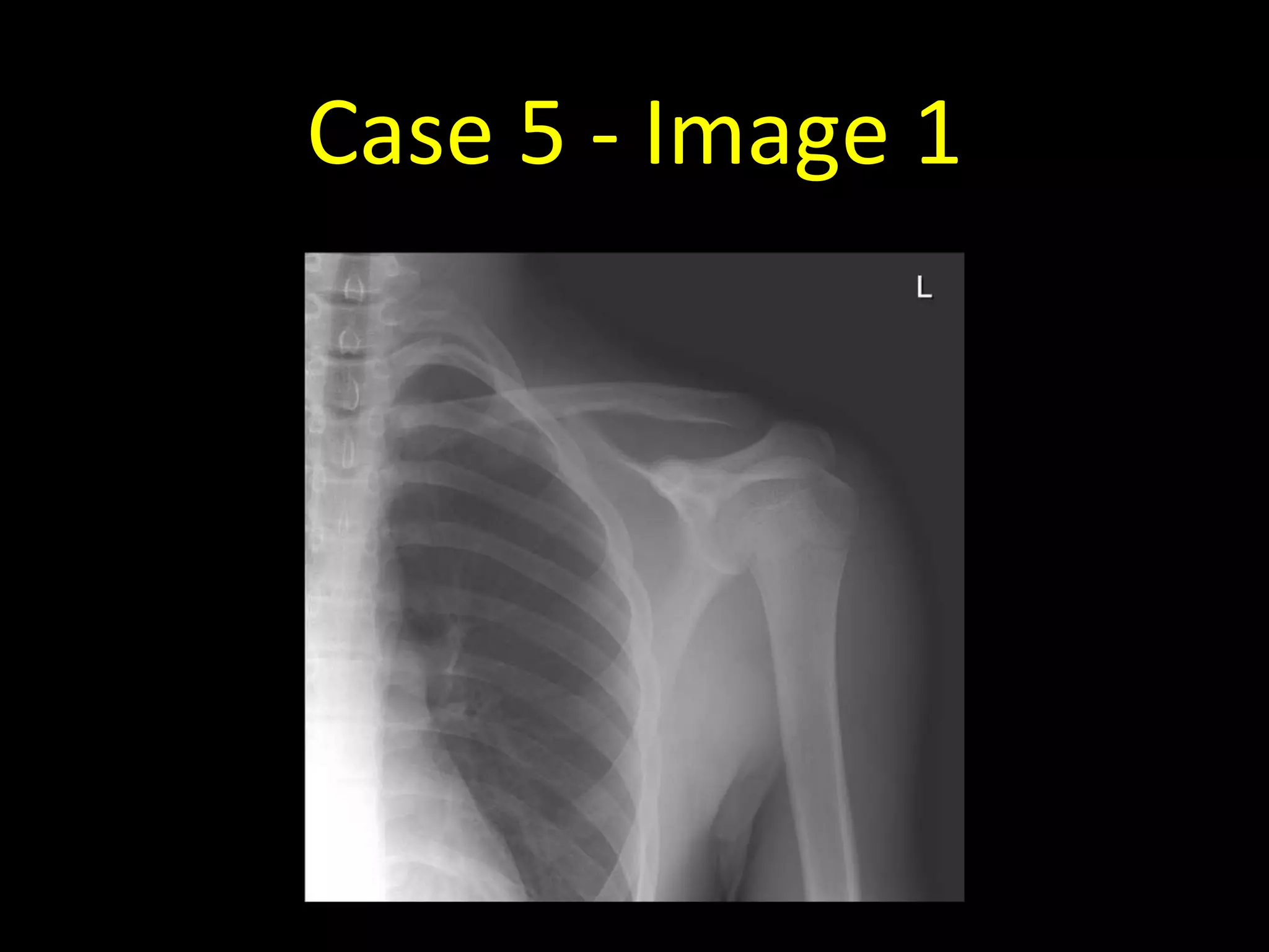 Case 5 - Image 1
 