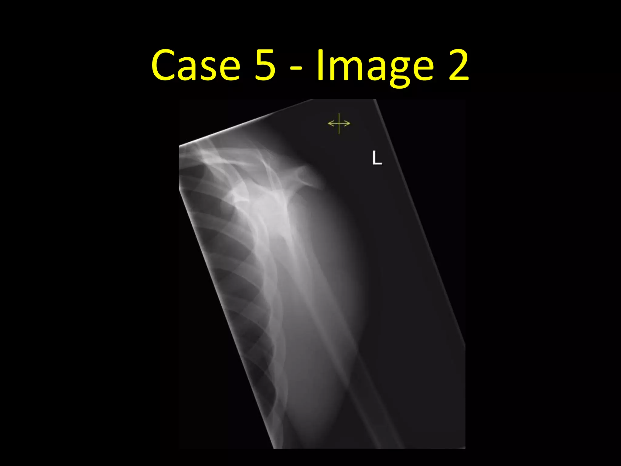 Case 5 - Image 2
 