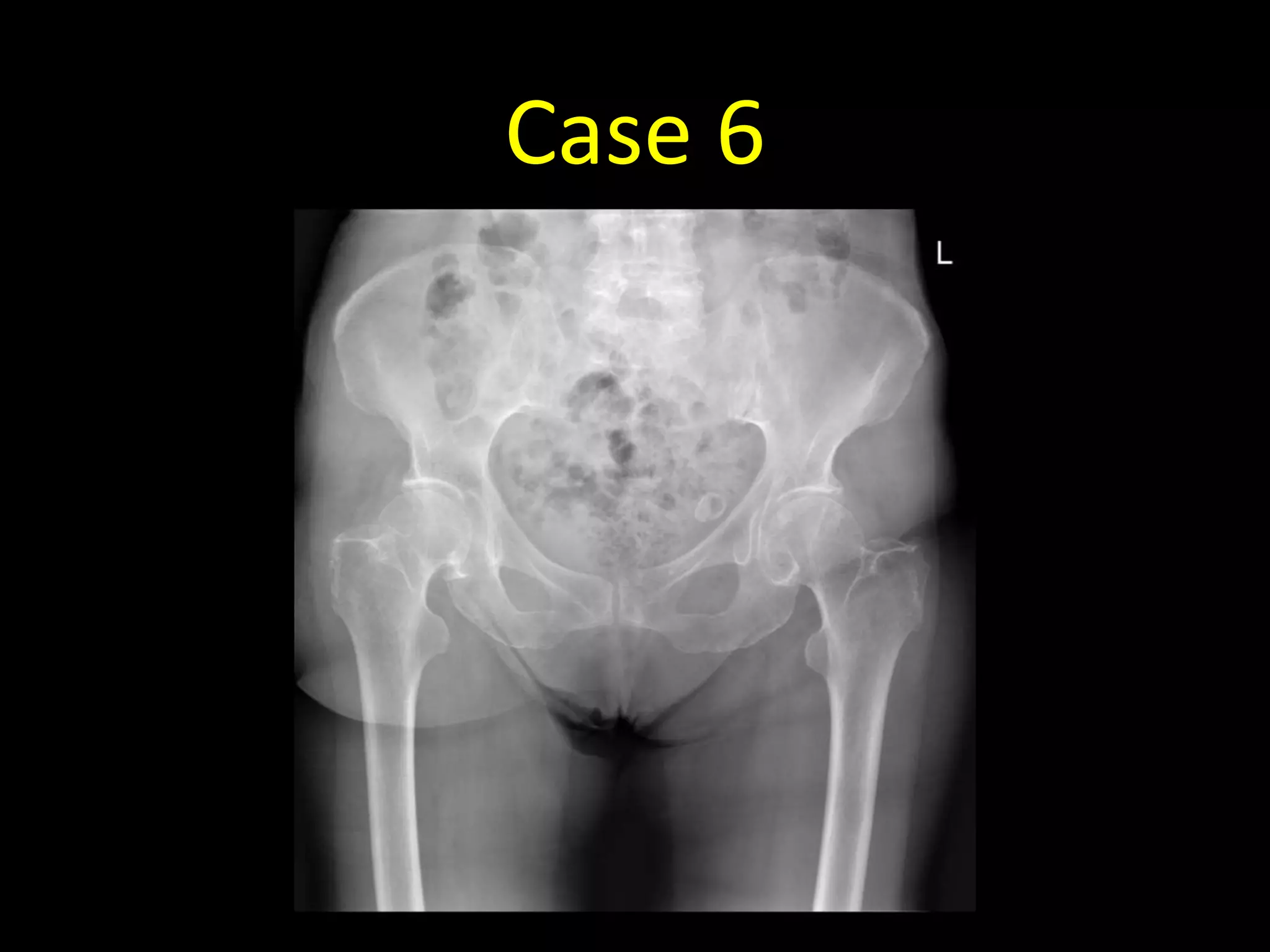 Case 6
 