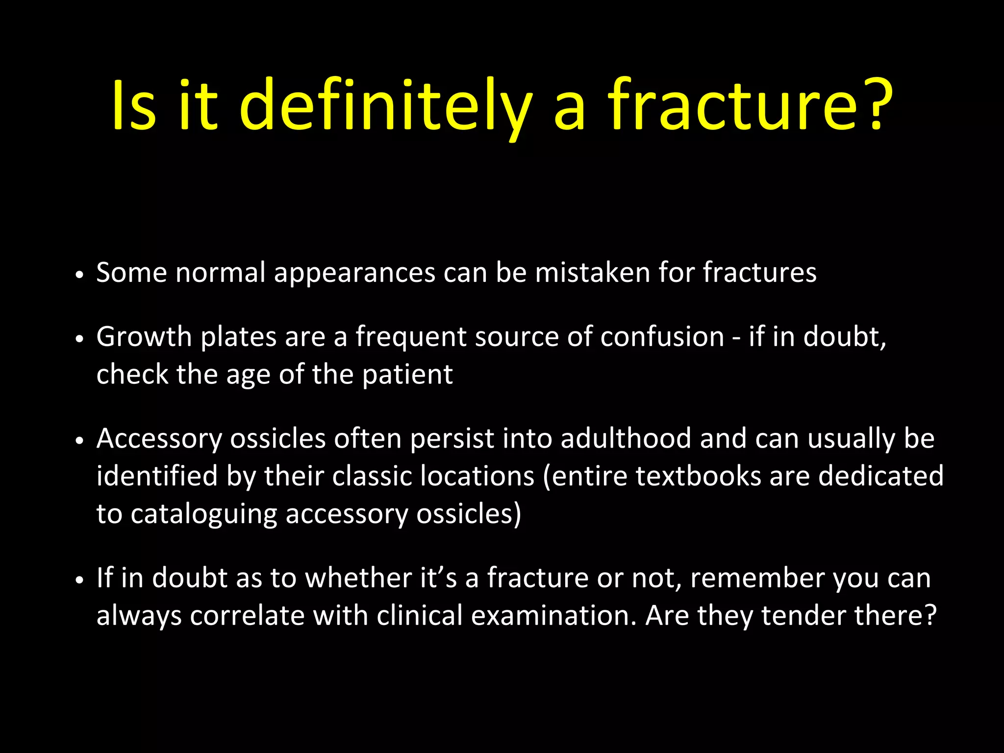 Is it definitely a fracture?
• Some normal appearances can be mistaken for fractures
• Growth plates are a frequent source of confusion - if in doubt,
check the age of the patient
• Accessory ossicles often persist into adulthood and can usually be
identified by their classic locations (entire textbooks are dedicated
to cataloguing accessory ossicles)
• If in doubt as to whether it’s a fracture or not, remember you can
always correlate with clinical examination. Are they tender there?
 