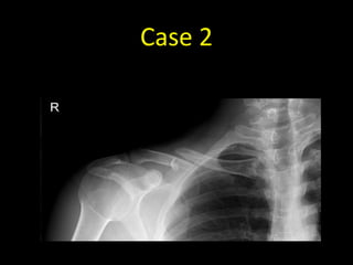 Case 2
 