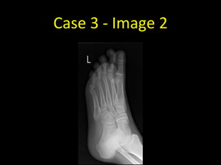 Case 3 - Image 2
 