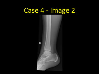 Case 4 - Image 2
 