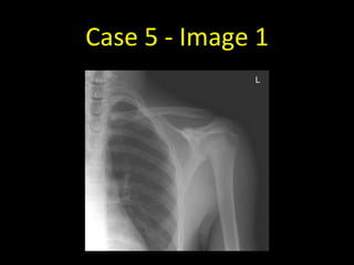 Case 5 - Image 1
 