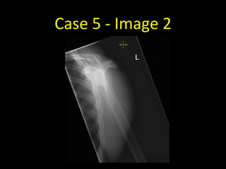 Case 5 - Image 2
 