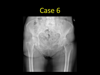 Case 6
 