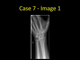 Case 7 - Image 1
 