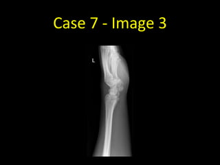 Case 7 - Image 3
 