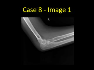 Case 8 - Image 1
 