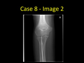 Case 8 - Image 2
 