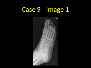 Case 9 - Image 1
 