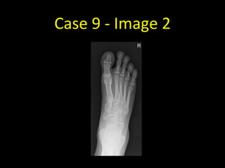 Case 9 - Image 2
 