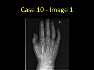 Case 10 - Image 1
 
