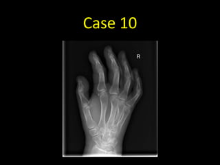 Case 10
 