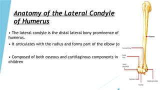 FRACTURE LATERAL CONDYLE HUMERUS BY DR KARAJ SANDHU.pptx