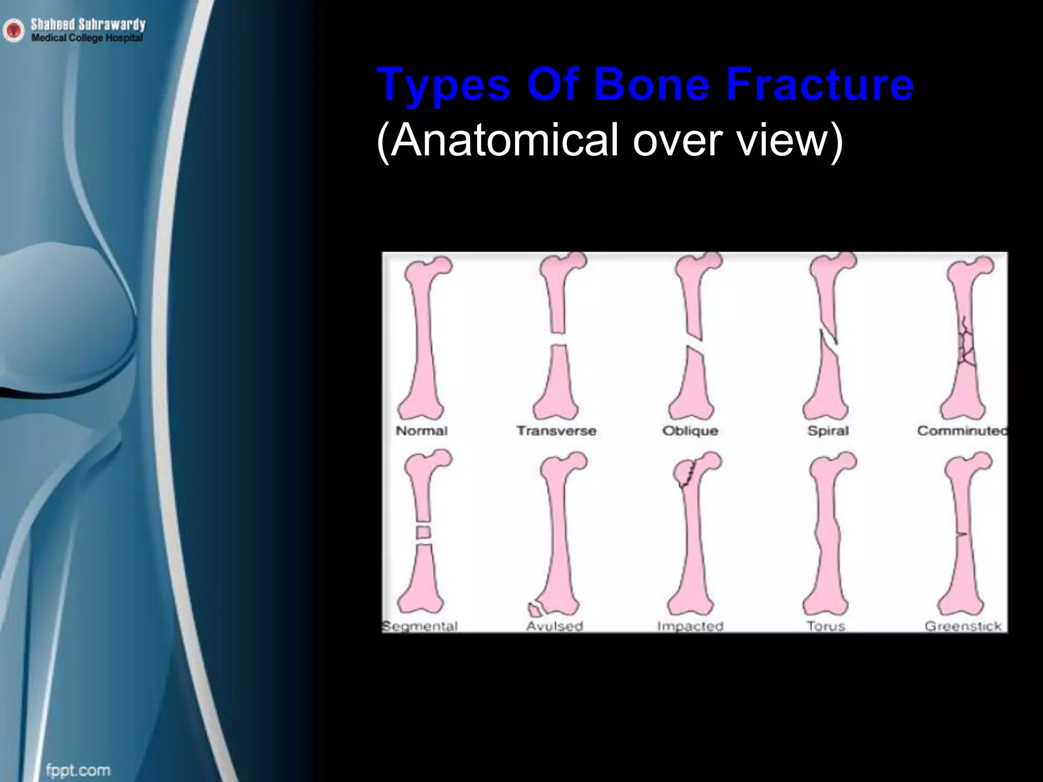 (Anatomical over view)