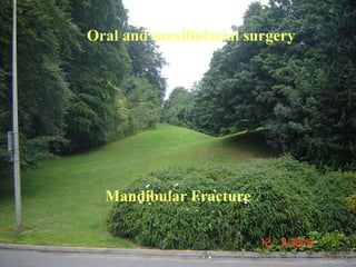 Oral and maxillofacial surgery
Mandibular Fracture
 