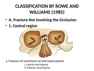 Rhowe Classification Comprehensive Radiographic Evaluation and Management of LeFort ...