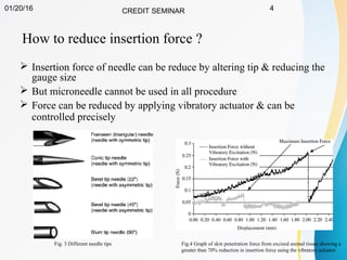 01/20/16 CREDIT SEMINAR 4
 Insertion force of needle can be reduce by altering tip & reducing the
gauge size
 But microneedle cannot be used in all procedure
 Force can be reduced by applying vibratory actuator & can be
controlled precisely
How to reduce insertion force ?
Fig.4 Graph of skin penetration force from excized animal tissue showing a
greater than 70% reduction in insertion force using the vibratory actuator
Fig. 3 Different needle tips
 