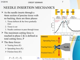 01/20/16 CREDIT SEMINAR 7
NEEDLE INSERTION MECHANICS
 As the needle inserts through a
4mm section of porcine tissue with
no backing, there are three phases
1. Tissue deflects & the force gradually
rises
2. Tissue is cut
3. Needle continues to pass through tissue
 The maximum cutting force is
reached in phase 2 & is defined as
total cutting force, P
 The three forces:
 Tearing force (Pt)
 Spreading force (PS)
 Friction force (PF)
Fig. 7 Force profile
of needle passing
through porcine skin
Fig. 8 Forces that compose total cutting force
 