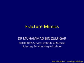 Fracture Mimics
DR MUHAMMAD BIN ZULFIQAR
PGR III FCPS Services institute of Medical
Sciences/ Services Hospital Lahore
Special thanks to Learning Radiology
 