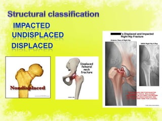4/17/2014 11
IMPACTED
UNDISPLACED
DISPLACED
 