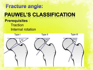 4/17/2014 15
Prerequisites :
Traction
Internal rotation
 