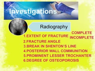 4/17/2014 20
Radiography
 