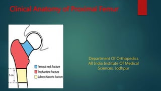 Clinical Anatomy of Proximal Femur
Dr. Khushwant Singh Rathore
Department Of Orthopedics
All India Institute Of Medical
Sciences, Jodhpur
 