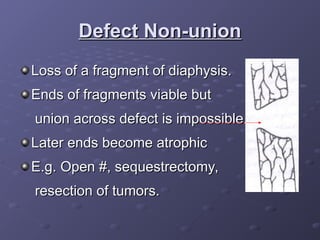 Fragment Defect Comprehensive Overview of Non-Union Fractures: Definitions, Causes, and ...