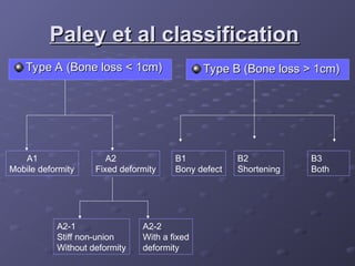 Comprehensive Overview of Non-Union Fractures: Definitions, Causes, and ...