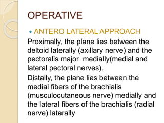 OPERATIVE
 ANTERO LATERAL APPROACH
Proximally, the plane lies between the
deltoid laterally (axillary nerve) and the
pectoralis major medially(medial and
lateral pectoral nerves).
Distally, the plane lies between the
medial fibers of the brachialis
(musculocutaneous nerve) medially and
the lateral fibers of the brachialis (radial
nerve) laterally
 