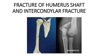FRACTURE OF HUMERUS SHAFT
AND INTERCONDYLAR FRACTURE
 