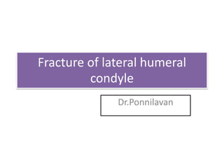 Fracture of lateral humeral
condyle
Dr.Ponnilavan
 
