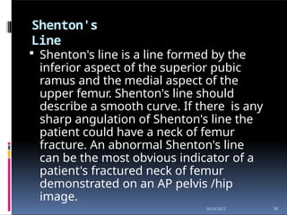 Shenton's
Line
34
10/16/2012
 Shenton's line is a line formed by the
inferior aspect of the superior pubic
ramus and the medial aspect of the
upper femur. Shenton's line should
describe a smooth curve. If there is any
sharp angulation of Shenton's line the
patient could have a neck of femur
fracture. An abnormal Shenton's line
can be the most obvious indicator of a
patient's fractured neck of femur
demonstrated on an AP pelvis /hip
image.
 