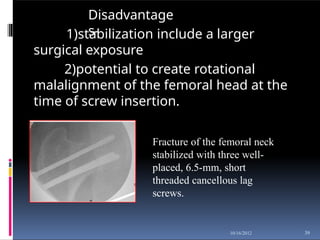 Disadvantage
s-
1)stabilization include a larger
surgical exposure
2)potential to create rotational
malalignment of the femoral head at the
time of screw insertion.
Fracture of the femoral neck
stabilized with three well-
placed, 6.5-mm, short
threaded cancellous lag
screws.
39
10/16/2012
 