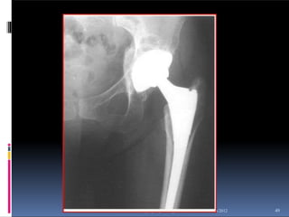 10/16/2012
copyright (your organization) 2003 49
 