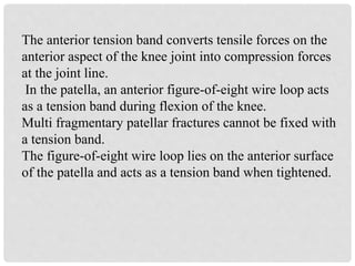 The anterior tension band converts tensile forces on the
anterior aspect of the knee joint into compression forces
at the joint line.
In the patella, an anterior figure-of-eight wire loop acts
as a tension band during flexion of the knee.
Multi fragmentary patellar fractures cannot be fixed with
a tension band.
The figure-of-eight wire loop lies on the anterior surface
of the patella and acts as a tension band when tightened.
 