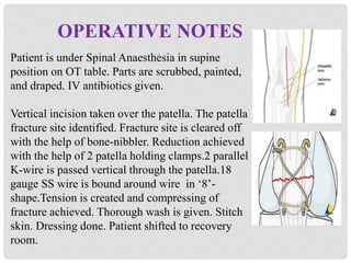 OPERATIVE NOTES
Patient is under Spinal Anaesthesia in supine
position on OT table. Parts are scrubbed, painted,
and draped. IV antibiotics given.
Vertical incision taken over the patella. The patella
fracture site identified. Fracture site is cleared off
with the help of bone-nibbler. Reduction achieved
with the help of 2 patella holding clamps.2 parallel
K-wire is passed vertical through the patella.18
gauge SS wire is bound around wire in ‘8’-
shape.Tension is created and compressing of
fracture achieved. Thorough wash is given. Stitch
skin. Dressing done. Patient shifted to recovery
room.
 