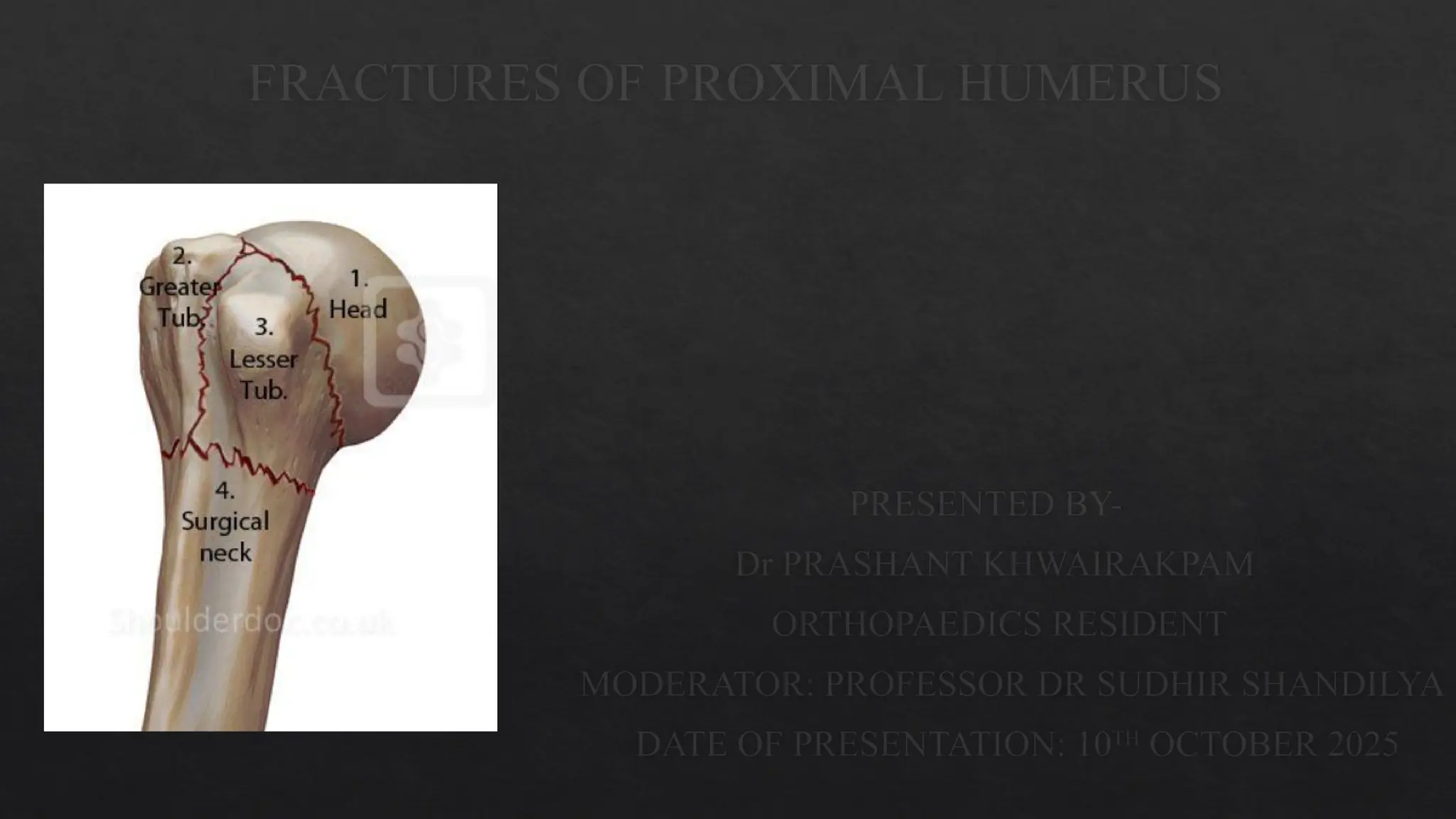 Fracture of proximal humerus by Dr Prashant KH.pptx