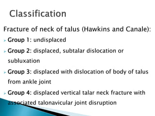 Fracture of talus ppt | PPTX