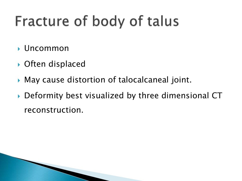 talus fracture treatment talus fracture treatment